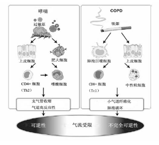 无创正压通气在慢阻肺急性加重期合并急性呼衰中的治疗